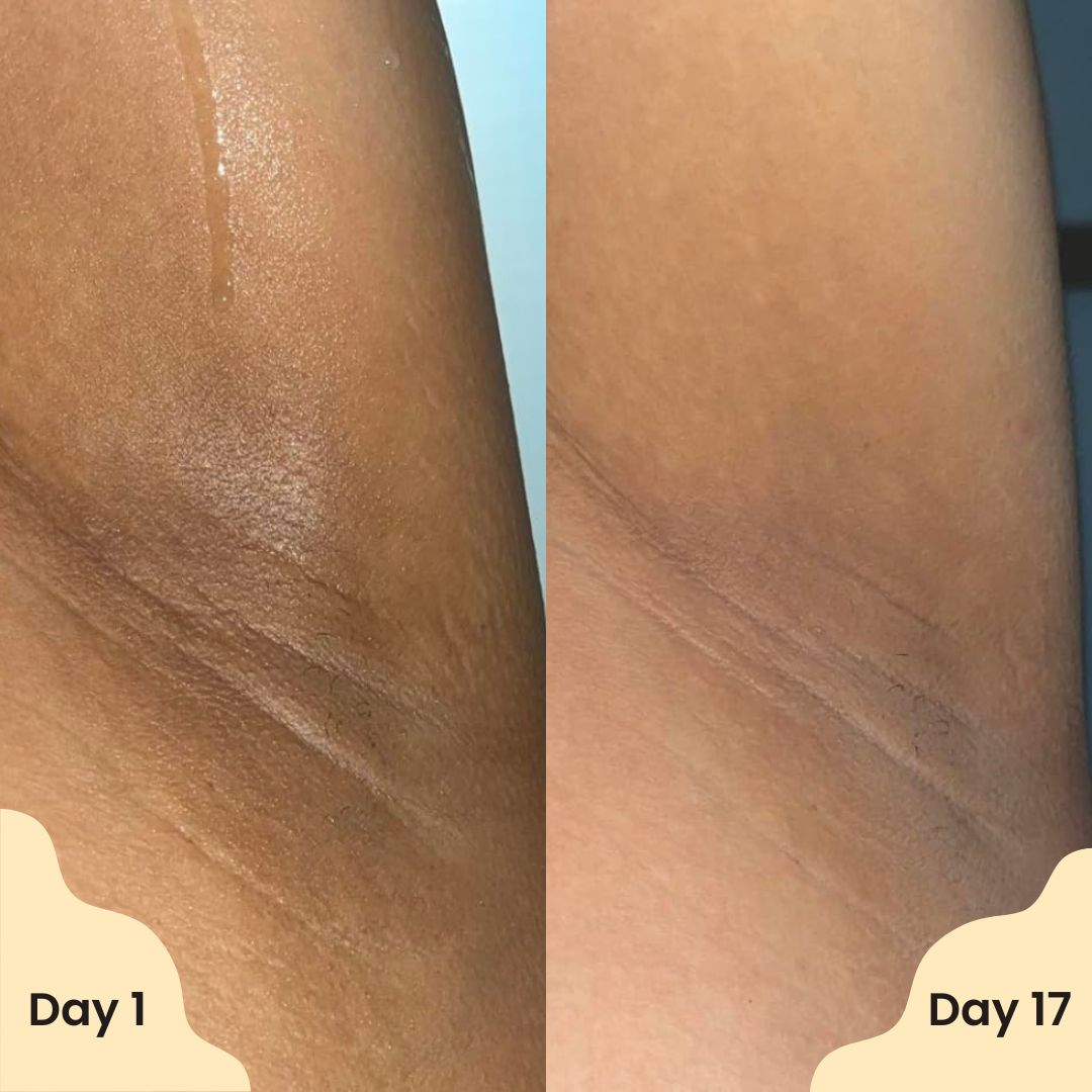 ✨ Elunarn® Vanilla Pistachio Brightening Deodorant — Smooth skin Underarms in Just Weeks 💛 ✨